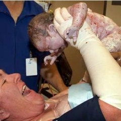 ¿De qué depende el éxito de una cesárea?