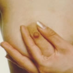 No estoy embarazada, pero me sale leche por los pechos. ¿Por qué?