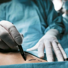 ¿TODOS LOS MIOMAS SE OPERAN? ¿TODOS LOS MIOMAS SE OPERAN?