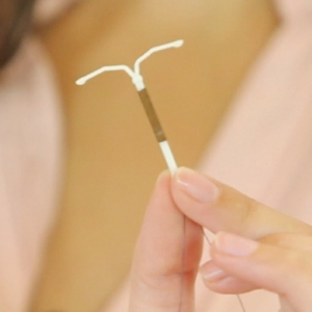 PUNTOS CLAVES: DISPOSITIVO INTRAUTERINO.