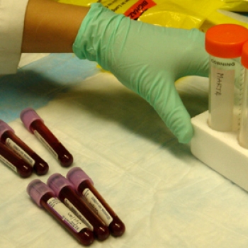 He escuchado que el semen debe ser de color blanco, pero en mi caso es amarillo y a veces con sangre. ¿Por qué?