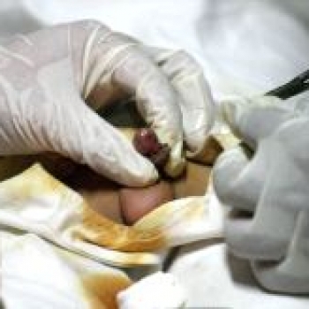 ¿Qué es una fimosis? ¿Qué es una fimosis?