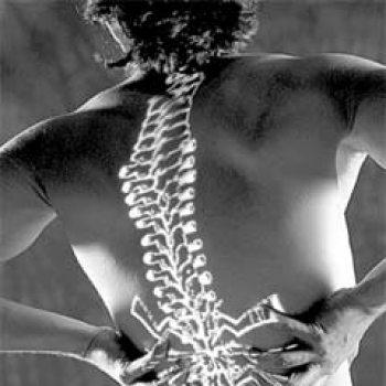 ¿Una hernia de disco afecta el desempeño sexual?