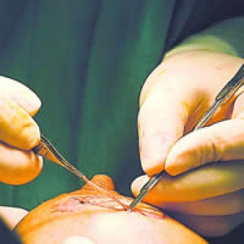 Me puse los implantes en el pecho, pero a mi esposo no le gustaron. ¿Me los puedo quitar?