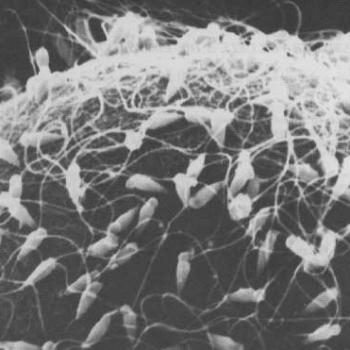 De la siguiente lista ¿Cuál desarrolla mayor velocidad? De la siguiente lista ¿Cuál desarrolla mayor velocidad?